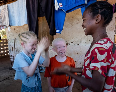 Two children with albinism playing games with a lady