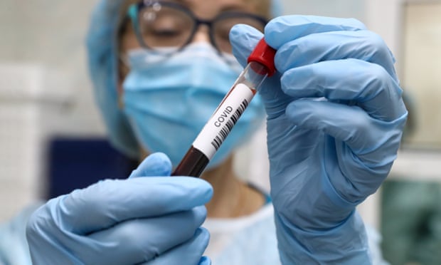 Are We Underestimating How Many People Are Resistant To Covid 19 Coronavirus The Guardian Are We Underestimating How Many People Are Resistant To Covid 19 Coronavirus The Guardian