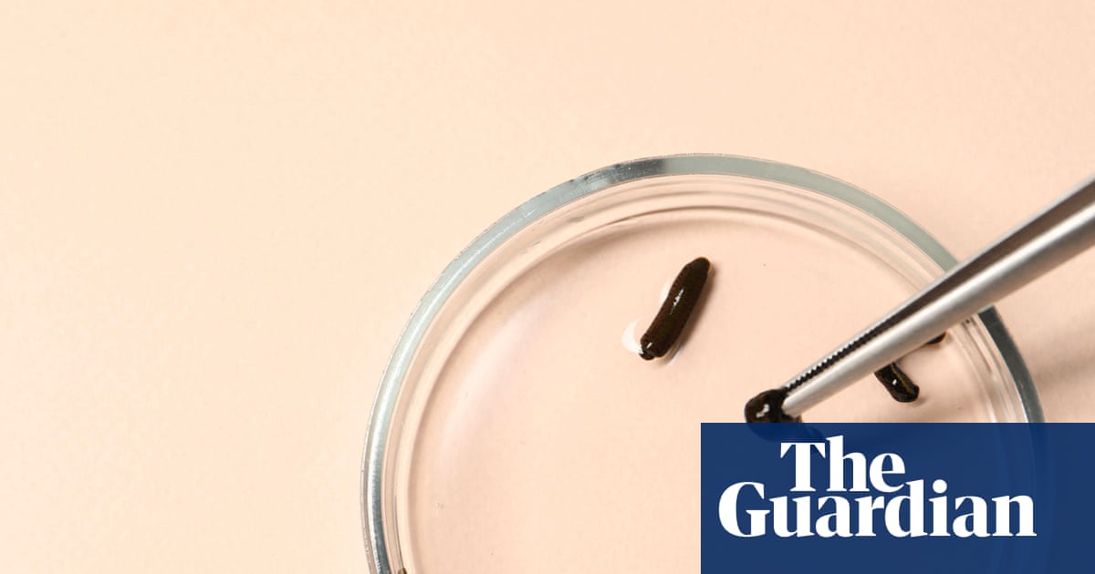 Hidden Creatures by Dino Martins review – the revolting world of parasites