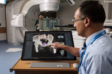 Microsoft Project InnerEye Study of a brain tumour