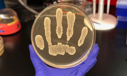 The presence of Staphylococcus epidermidis, pictured, may provide natural protection against skin cancer.