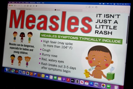 A website with information about measles and how to spot it.