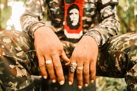 A close up of man's hands with one finger missing