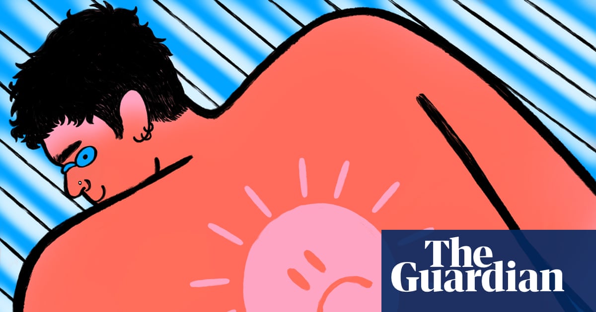 does melanotan ii reduce sunburn risk Burn notice: Gen Z and the terrifying rise of extreme tanning | Health & wellbeing