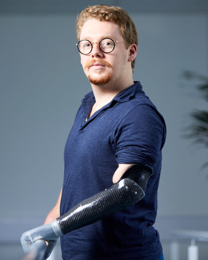 Futuristic bionic arm helps amputees feel the sensation of touch and  movement - CNET