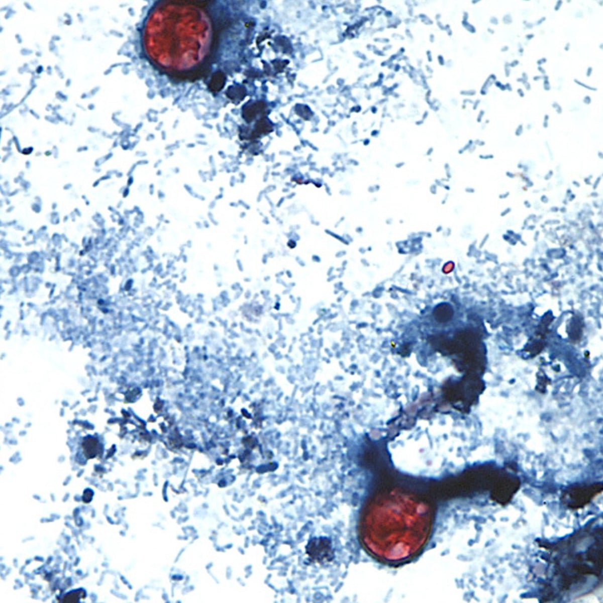 Michigan health officials identify 'potential source' of parasite outbreak | US healthcare