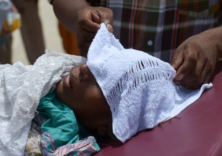Close up of a pair of hands placing a wet towel on a person’s head