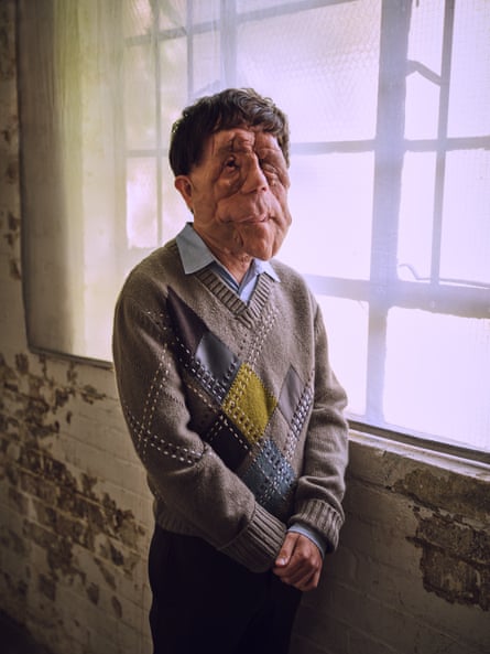 What Happened To Adam Pearson? Unveiling His Journey