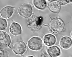 Cancer cell explosion.