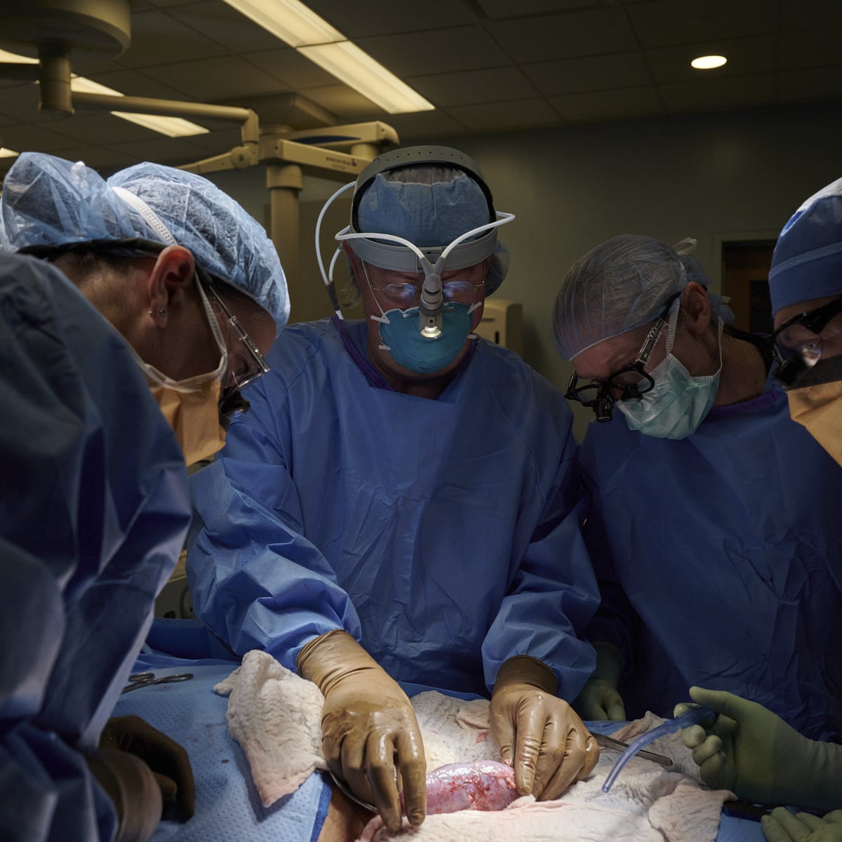 Pig kidney transplant 2020