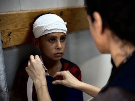 In the Palestinian-American emergency room (ER), a nurse works hard to save lives at Nasser Hospital, where she started volunteering about a month ago in Khan Younis