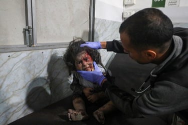 A medic wearing blue gloves tends to a girl whose face is bloodied