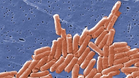 Salmonella bacteria as seen through a microscope