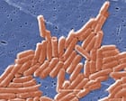Climate crisis is accelerating antibiotic resistance across world, study says