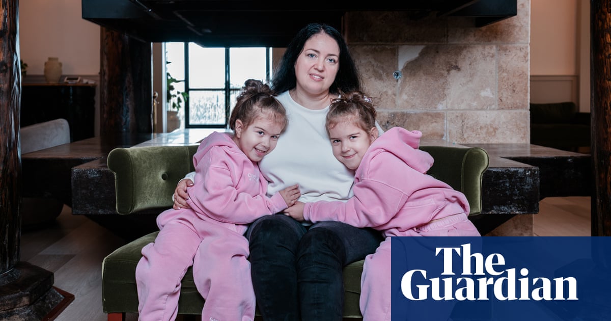 Experience: my daughters were born conjoined at the head