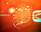 UK-based couple say overseas surrogacy agency made twins using wrong sperm
