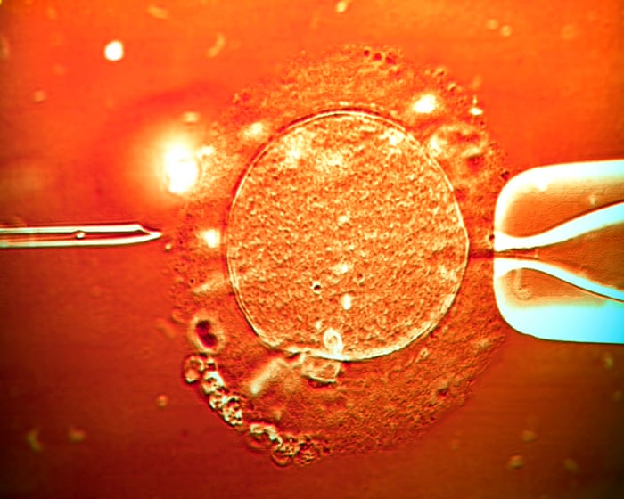 UK-based couple say overseas surrogacy agency made twins using wrong sperm