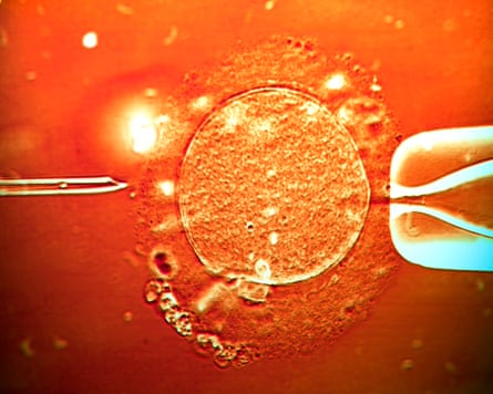 IVF curen sperm being injected into quality egg