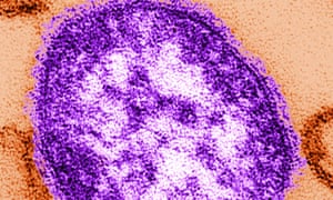 Measles virus