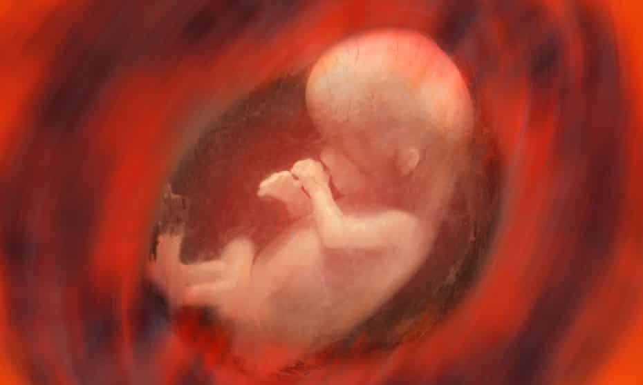 Internal view of a human fetus - approx. 10 weeks