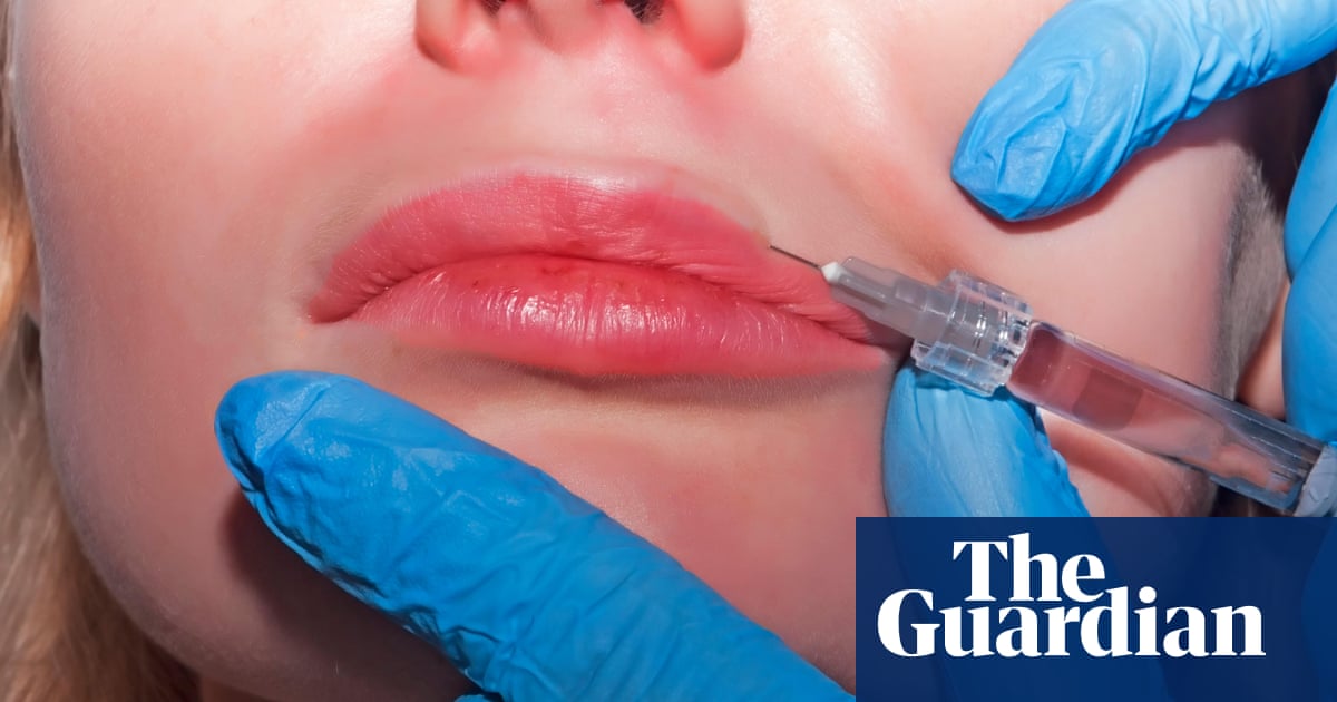 Three women diagnosed with HIV after getting ‘vampire facials’ in New Mexico - The Guardian