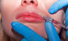 Hands wearing blue gloves holding needle pointed at person's lips