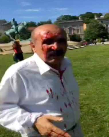 A man is seen bloodied from head wounds outside the Turkish ambassador’s residence in Washington.