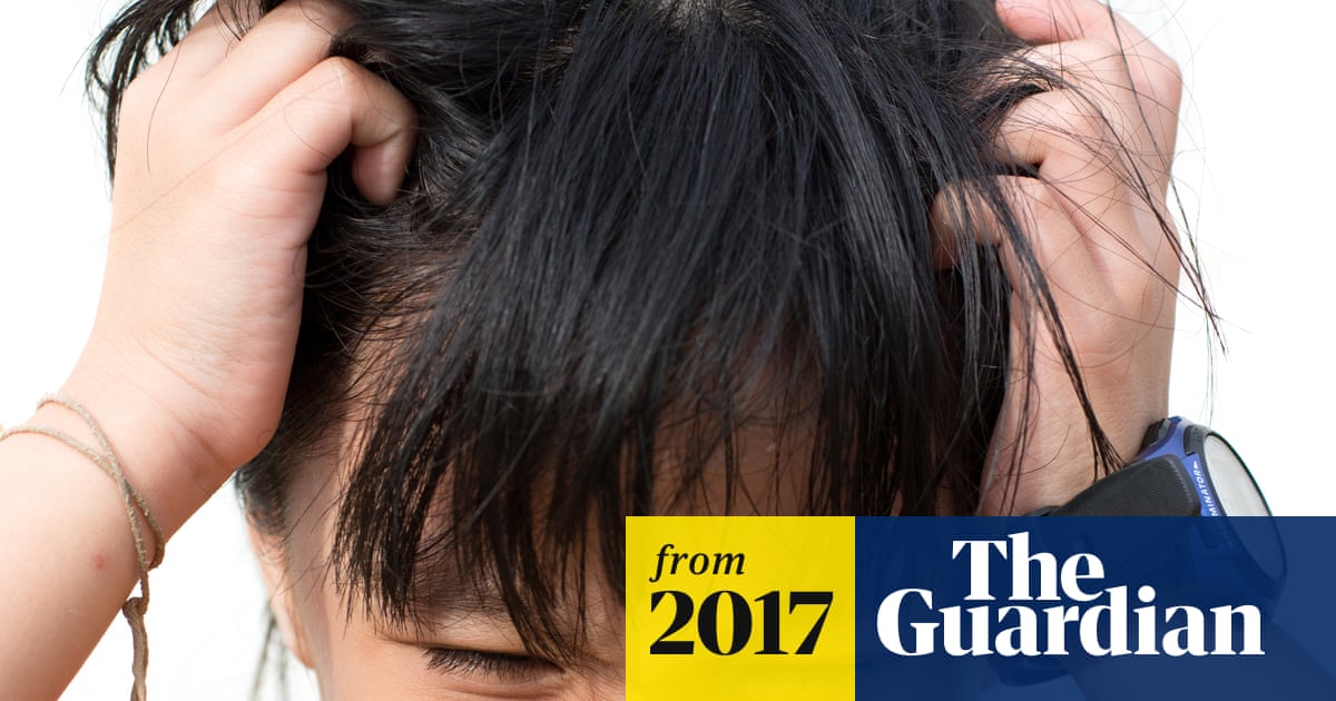 NHS England plans to cut indigestion and dandruff prescriptions | NHS | The  Guardian