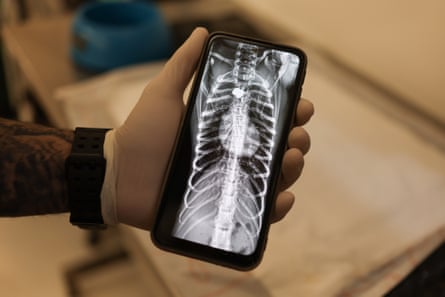 close up of an x-ray displayed on a phone