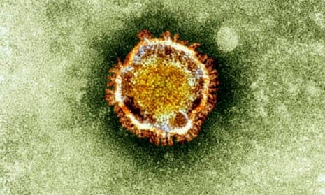 An electron microscope image of a coronavirus.
