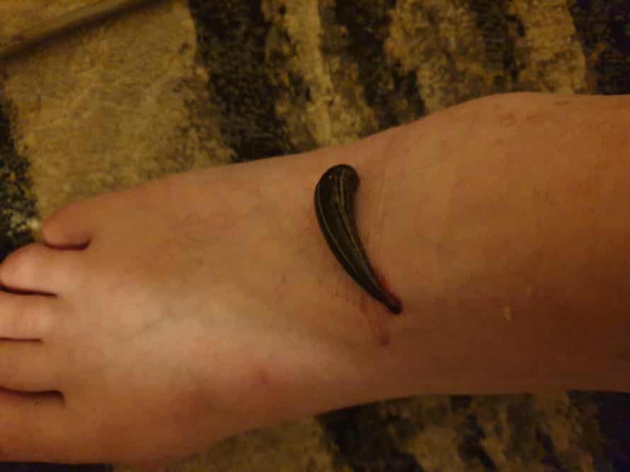 A leech found in Linda Campbell’s home