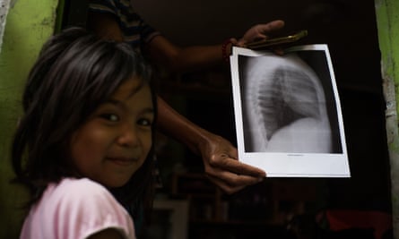 Five-year-old Shantal has been diagnosed with pneumonia three times, something her community blames on the fact she lives less than 100 meters from a plastics recycling plant in Canumay West village.