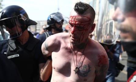 An injured England fan is arrested after clashes in Marseille