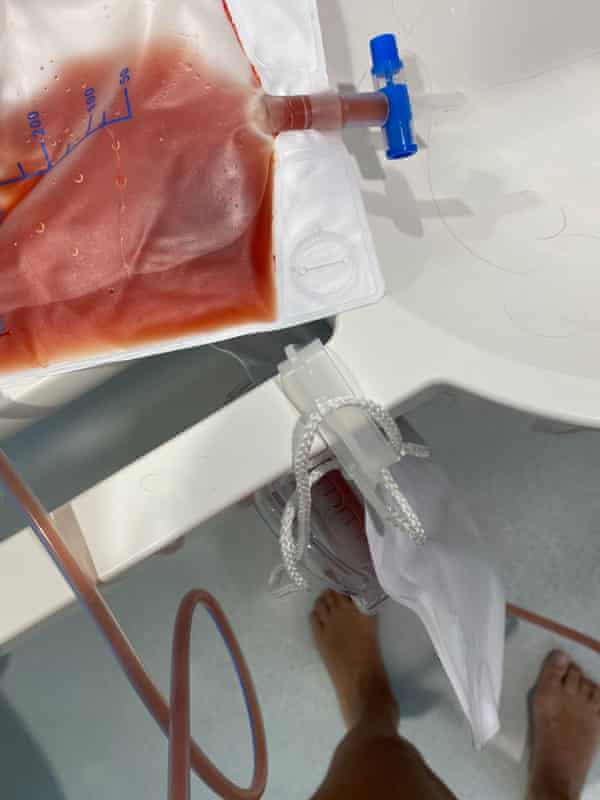 We All Bleed, 2020 … a self-portrait taken in hospital after her major operation.