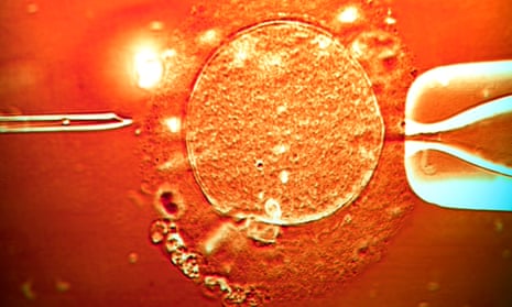 Color light micrograph of a micro-needle about to inject human sperm into a human egg cell