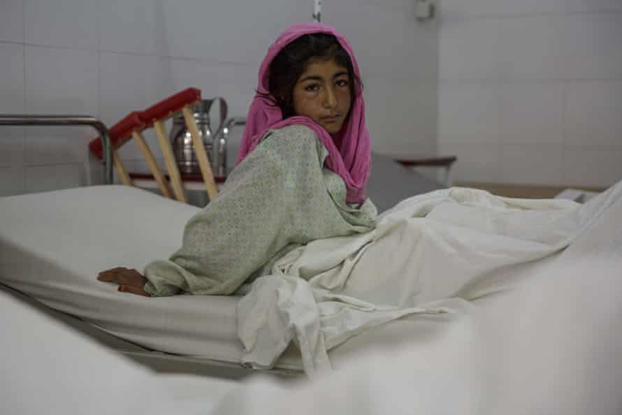 A patient in a hopsital in Lashkargar, Helmand, after their houses in Gereshk were hit by a drone.