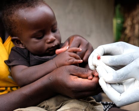 A small baby in uganda wearing a yellow dress, held by its mother while a health worker wearing white surgical gloves takes a small sample of blood from the baby's hand