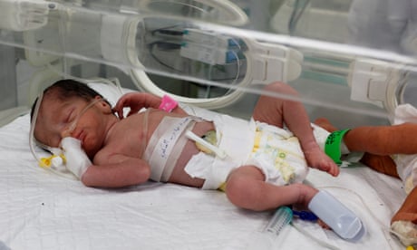 Gaza doctors save baby from womb of mother killed in Israeli airstrike