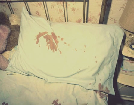 A pillowcase stained with blood