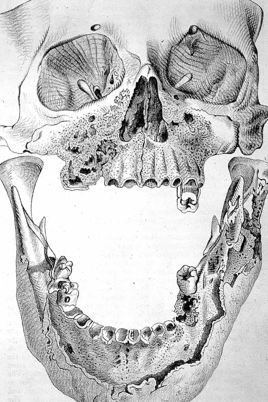 The Devil S Element The Dark Side Of Phosphorus Science The Guardian The Devil S Element The Dark Side Of Phosphorus Science The Guardian
