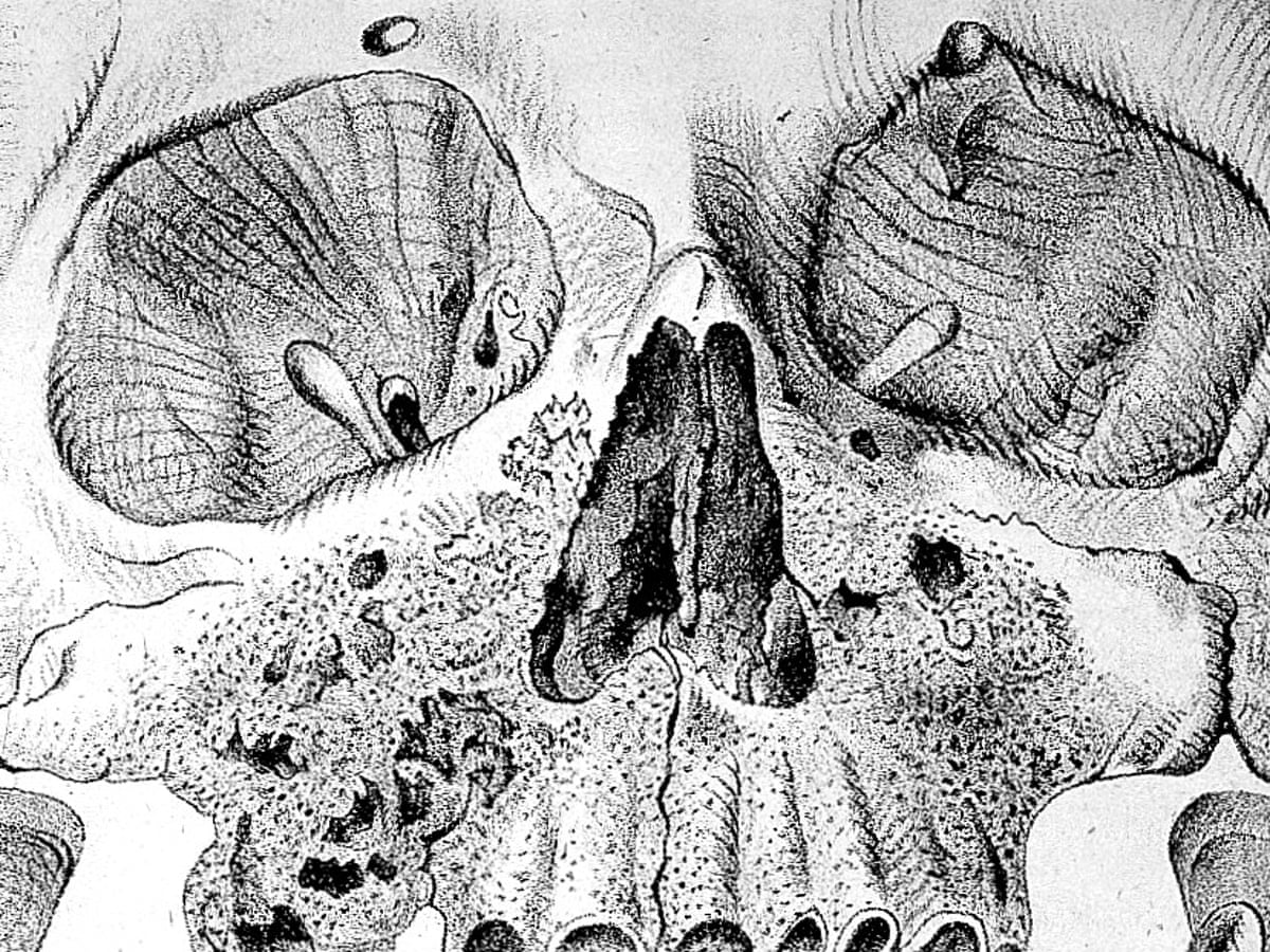 The Devil S Element The Dark Side Of Phosphorus Science The Guardian The Devil S Element The Dark Side Of Phosphorus Science The Guardian