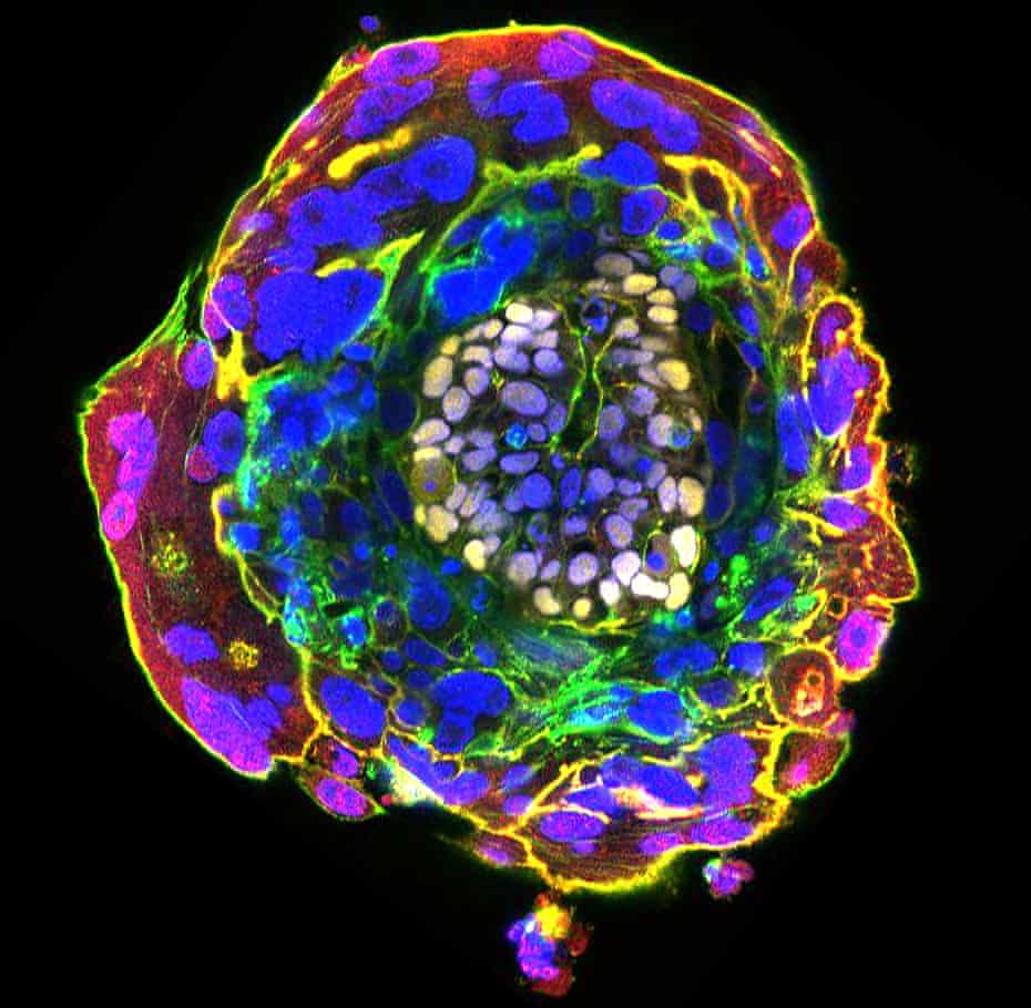 An image of a human embryo at day 11 of development.