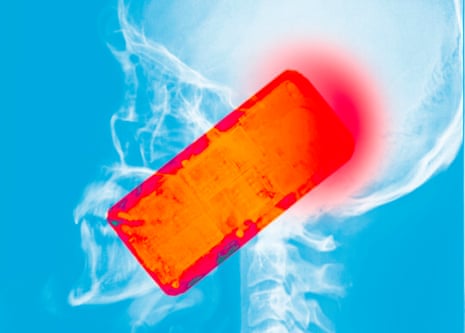coloured x-ray of a man using a mobile phone