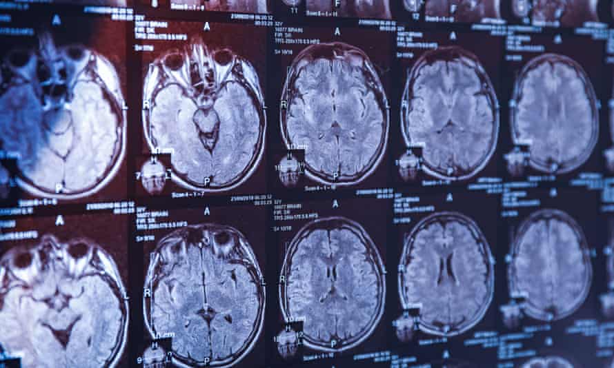 Government inquiry shows how seriously sport must take brain injury | Concussion in sport 1 6720