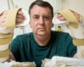Chris King after his double hand transplant