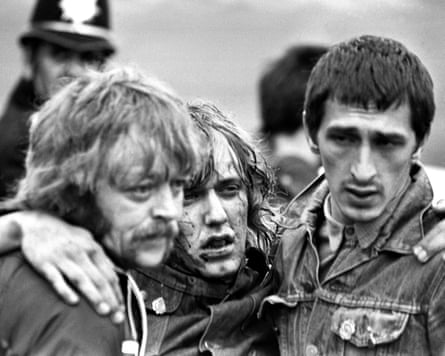 An injured man is helped away by fellow pickets.