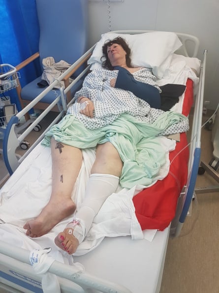 A woman lies injured in a hospital bed