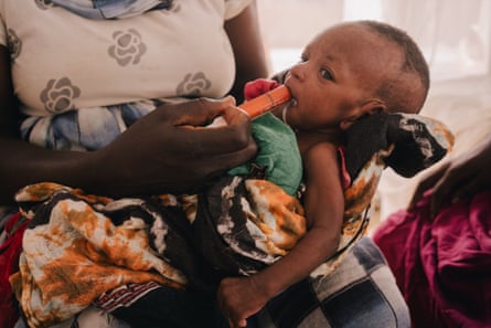A newborn African baby is fed through a syringe