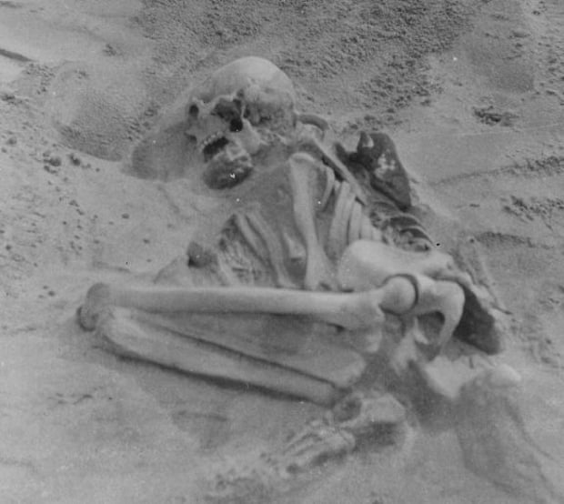 The skeleton