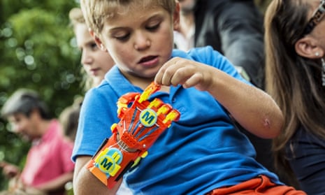 A young boy born with a right hand malformation examines his new 3D-printed hand